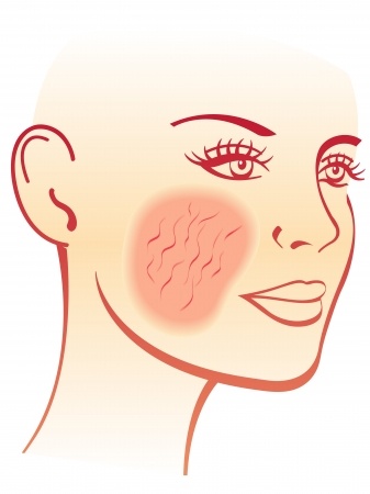 cartoon image of woman with red cheeks