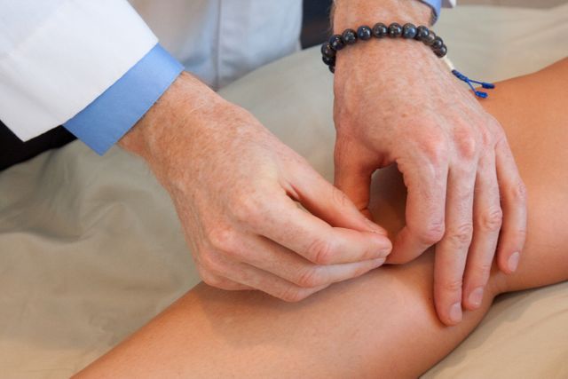 acupuncture needle being inserted in a patients leg