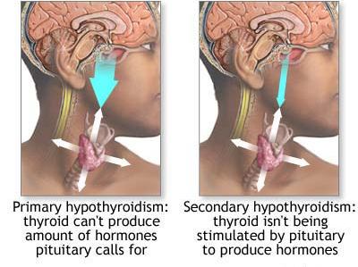 primary vs secondary hypothyroidism