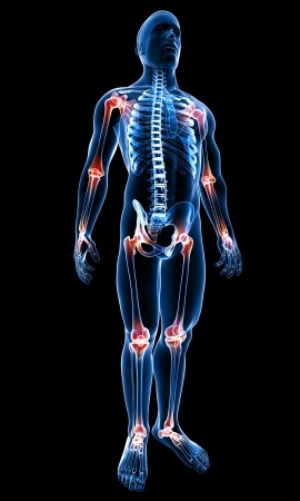 joint-pain-acupuncture – Acupuncture & Dry Needling, Santa Monica, CA